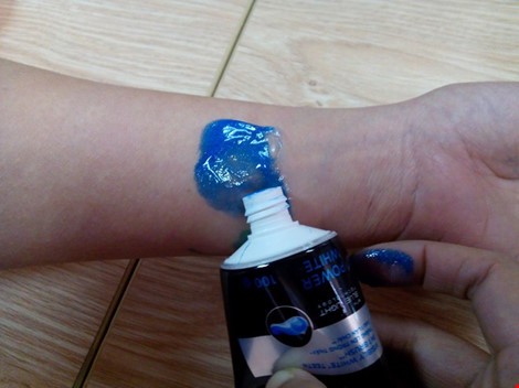 Những Giấc Mơ Khác Liên Quan Đến Bỏng