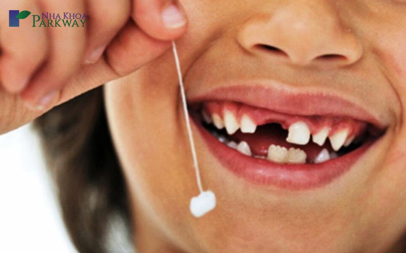 Mơ thấy bị rụng răng cửa